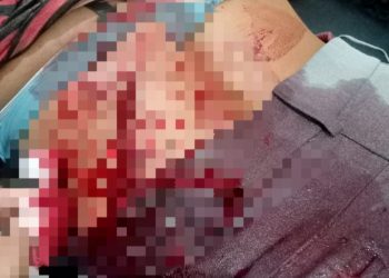 Perampokan Sapi di Wanaraya, Seorang Ibu Jadi Korban Pembacokan